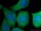 Cyclin Dependent Kinase 6 antibody, 14052-1-AP, Proteintech Group, Immunofluorescence image 