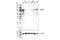 Signal Transducer And Activator Of Transcription 5B antibody, 34662S, Cell Signaling Technology, Western Blot image 