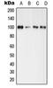 Glutamate Ionotropic Receptor AMPA Type Subunit 4 antibody, LS-C352280, Lifespan Biosciences, Western Blot image 