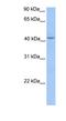 Hydroxymethylbilane Synthase antibody, NBP1-56627, Novus Biologicals, Western Blot image 