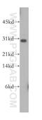 TRBV5-4 antibody, 13524-1-AP, Proteintech Group, Western Blot image 