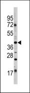 POU Class 5 Homeobox 1 antibody, TA324706, Origene, Western Blot image 