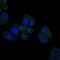 Hereditary hemochromatosis protein antibody, GTX60503, GeneTex, Immunocytochemistry image 