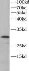 Thymidine Kinase 1 antibody, FNab10728, FineTest, Western Blot image 