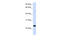 Paired Immunoglobin Like Type 2 Receptor Beta antibody, 26-179, ProSci, Western Blot image 