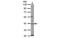 Gamma-Butyrobetaine Hydroxylase 1 antibody, MBS835147, MyBioSource, Western Blot image 