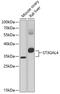 ST3 Beta-Galactoside Alpha-2,3-Sialyltransferase 4 antibody, 15-059, ProSci, Western Blot image 