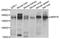 MER Proto-Oncogene, Tyrosine Kinase antibody, STJ27396, St John