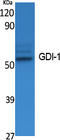 Rho GDP Dissociation Inhibitor Alpha antibody, STJ96399, St John