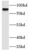 Tousled Like Kinase 1 antibody, FNab08724, FineTest, Western Blot image 