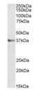 Activating Transcription Factor 1 antibody, orb1905, Biorbyt, Western Blot image 
