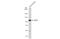 Angiotensin I Converting Enzyme 2 antibody, GTX135404, GeneTex, Western Blot image 