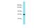 Centrosomal Protein 104 antibody, A12406, Boster Biological Technology, Western Blot image 