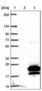 SNAP Associated Protein antibody, PA5-61389, Invitrogen Antibodies, Western Blot image 