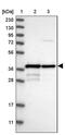 Mitochondrial RRNA Methyltransferase 1 antibody, PA5-54466, Invitrogen Antibodies, Western Blot image 