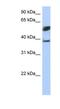 Speckle Type BTB/POZ Protein Like antibody, NBP1-79344, Novus Biologicals, Western Blot image 