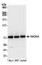 Hydroxyacyl-CoA Dehydrogenase Trifunctional Multienzyme Complex Subunit Alpha antibody, A305-317A, Bethyl Labs, Western Blot image 