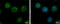 Charged multivesicular body protein 5 antibody, GTX106692, GeneTex, Immunofluorescence image 