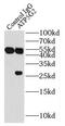 ATP Synthase Membrane Subunit C Locus 2 antibody, FNab00708, FineTest, Immunoprecipitation image 