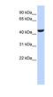 Retinol Dehydrogenase 16 antibody, NBP1-58060, Novus Biologicals, Western Blot image 