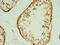 Trafficking Protein Particle Complex 2 Like antibody, CSB-PA892461LA01HU, Cusabio, Immunohistochemistry frozen image 