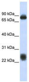 Tetraspanin 8 antibody, TA339425, Origene, Western Blot image 