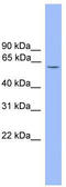 Ariadne RBR E3 Ubiquitin Protein Ligase 2 antibody, TA344535, Origene, Western Blot image 
