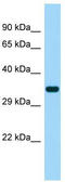 Succinate Receptor 1 antibody, TA334388, Origene, Western Blot image 