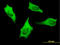 Myosin Heavy Chain 9 antibody, LS-B5476, Lifespan Biosciences, Immunofluorescence image 