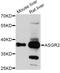 Asialoglycoprotein Receptor 2 antibody, A10123, Boster Biological Technology, Western Blot image 