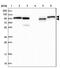 TBC1 Domain Containing Kinase antibody, PA5-59007, Invitrogen Antibodies, Western Blot image 