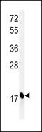 Complexin 1 antibody, LS-C166990, Lifespan Biosciences, Western Blot image 