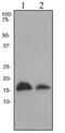 Anterior Gradient 2, Protein Disulphide Isomerase Family Member antibody, ab76473, Abcam, Western Blot image 