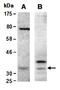 Calponin 1 antibody, orb66947, Biorbyt, Western Blot image 