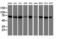 Dystrobrevin Beta antibody, LS-C173759, Lifespan Biosciences, Western Blot image 