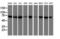 Dystrobrevin beta antibody, LS-C173759, Lifespan Biosciences, Western Blot image 