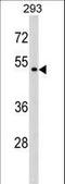 Purinergic Receptor P2X 6 antibody, LS-C163316, Lifespan Biosciences, Western Blot image 