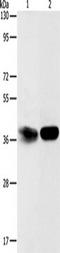 ADP-Ribosylhydrolase Like 2 antibody, TA350881, Origene, Western Blot image 