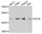 Eukaryotic Translation Initiation Factor 3 Subunit E antibody, LS-C346085, Lifespan Biosciences, Western Blot image 