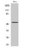 CUGBP Elav-Like Family Member 1 antibody, STJ92521, St John