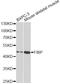 FGF1 Intracellular Binding Protein antibody, A13572, ABclonal Technology, Western Blot image 