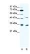 Zinc Finger Protein 488 antibody, NBP1-80174, Novus Biologicals, Western Blot image 