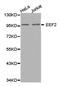Eukaryotic Translation Elongation Factor 2 antibody, LS-C192760, Lifespan Biosciences, Western Blot image 