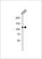 Mindbomb E3 Ubiquitin Protein Ligase 1 antibody, GTX53672, GeneTex, Western Blot image 