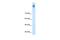 Solute Carrier Family 12 Member 2 antibody, PA5-69256, Invitrogen Antibodies, Western Blot image 