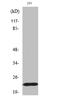BCL2 Associated Agonist Of Cell Death antibody, A03520S155-1, Boster Biological Technology, Western Blot image 