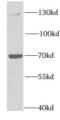 Protein Tyrosine Phosphatase Receptor Type A antibody, FNab06942, FineTest, Western Blot image 