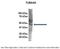 Tubulin alpha-4A chain antibody, ARP40179_P050, Aviva Systems Biology, Immunoprecipitation image 