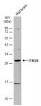 Integral Membrane Protein 2B antibody, NBP2-17000, Novus Biologicals, Western Blot image 