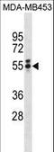 T antibody, LS-C156190, Lifespan Biosciences, Western Blot image 